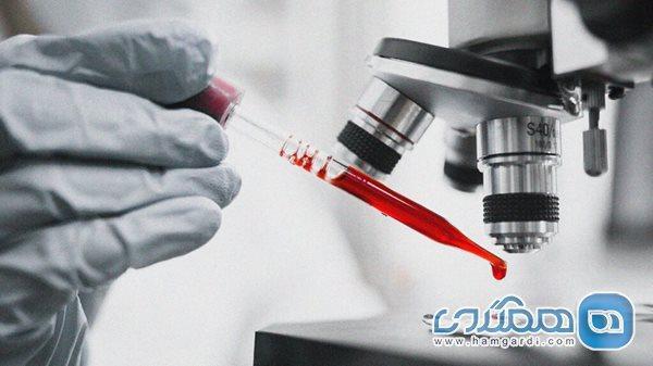 تست cbc چیست و چه بیماری هایی را آشکار می کند؟ تست cbc چیست و چه بیماری هایی را آشکار می کند؟