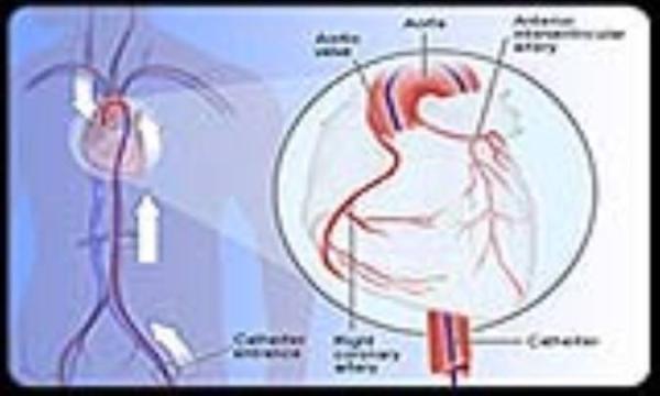دی اکسید کربن به عنوان مادة حاجب دی اکسید کربن به اسم مادة حاجب