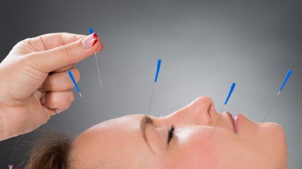 طب سوزنی روی صورت زن چینی