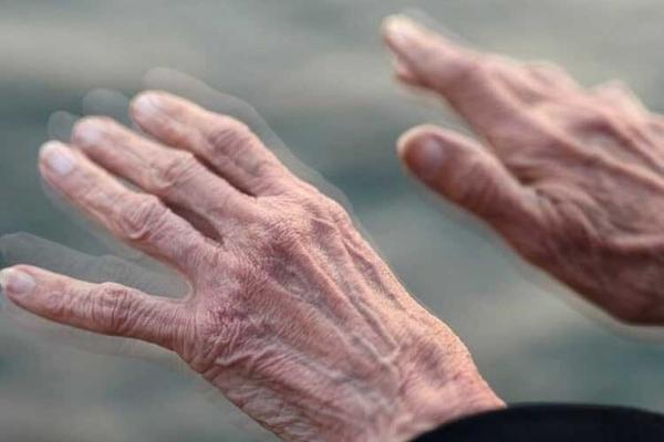 علائم اولیه بیماری پارکینسون علائم اولیه بیماری پارکینسون